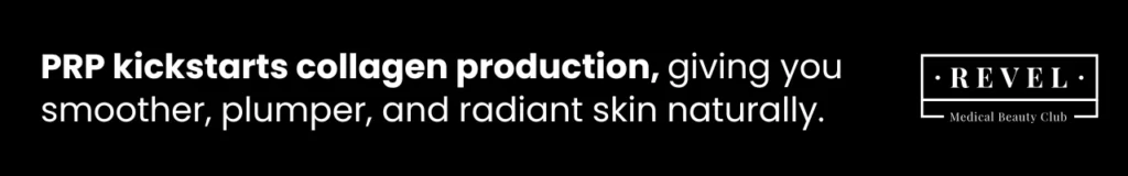 PRP stimulates collagen production, helping to create smoother, plumper, and radiant skin naturally.