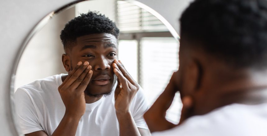 A tired-looking black man touching the dark circles under his eyes, representing the emotional and physical impact of under eye hollows. This image captures the importance of treating under eye hollows, and the impact it can have on one's appearance and self-esteem.